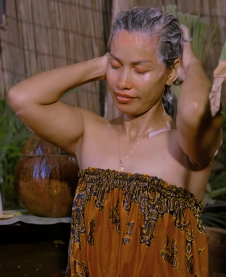 hair-loss-cambodia